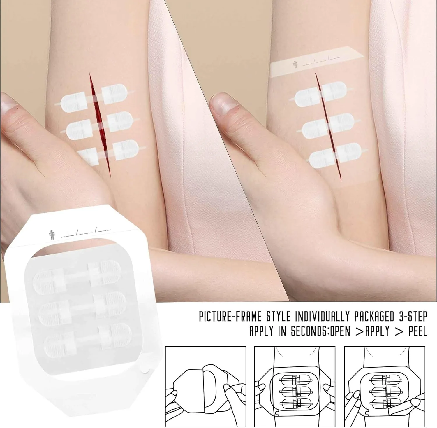 Emergency Wound Closure Strips Kit Set,Sutures Butterfly Bandaids, Ifak Trauma Kit Refill First Aid Supplies for Hiking Camping Backpacks, Zip Stitch Wound Closure Strips(White, Large)