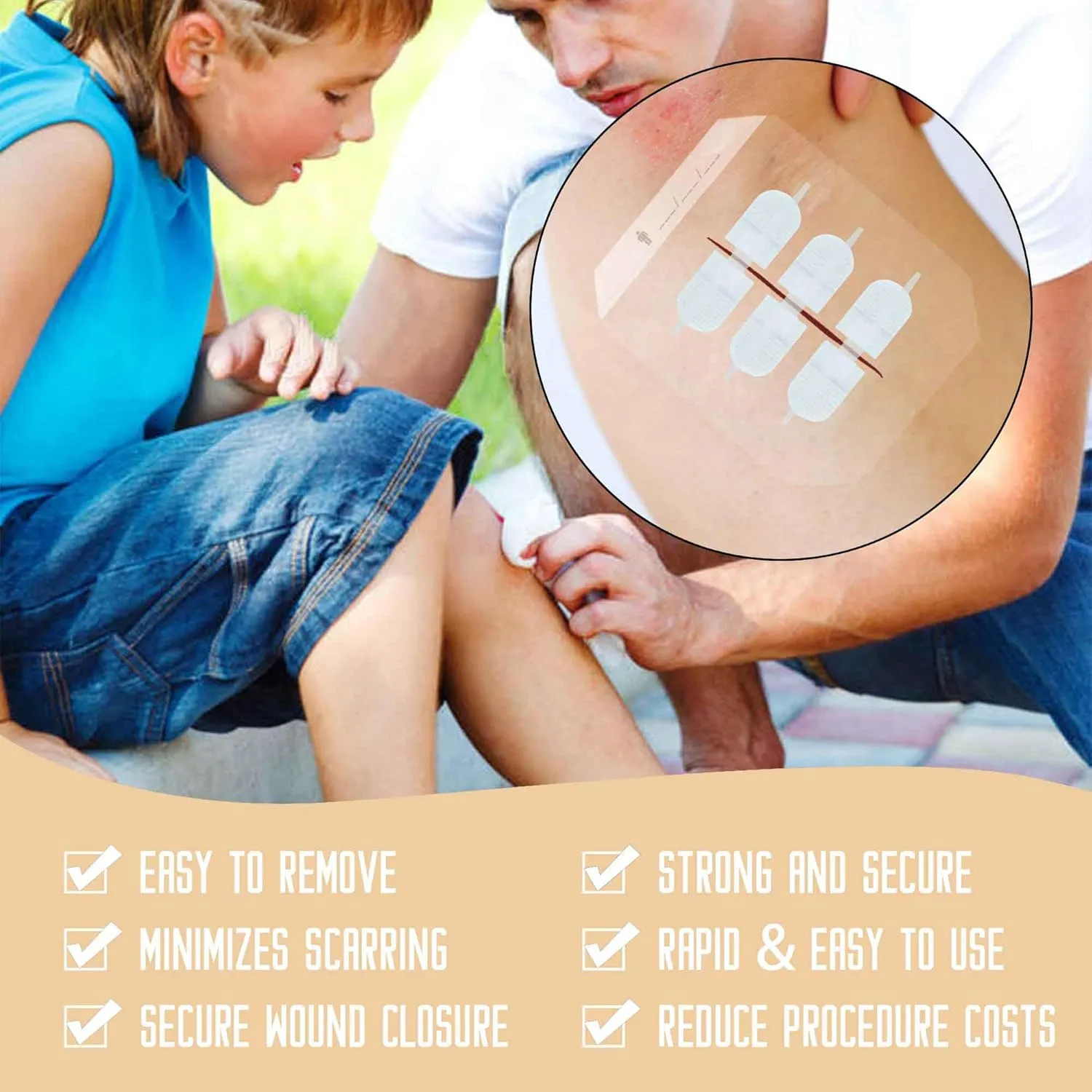 Emergency Wound Closure Strips Kit Set,Sutures Butterfly Bandaids, Ifak Trauma Kit Refill First Aid Supplies for Hiking Camping Backpacks, Zip Stitch Wound Closure Strips(White, Large)