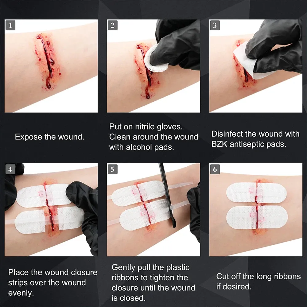 Zip Stitch Wound Closure Kit 6pcs